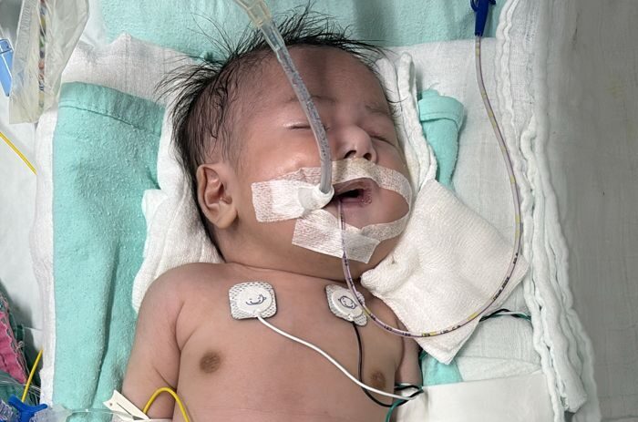 Bayi hidap masalah jantung cacat perlu dana RM110,000