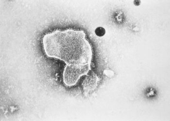 VIRUS RSV menyerang ramai kanak-kanak di AS .-AGENSI