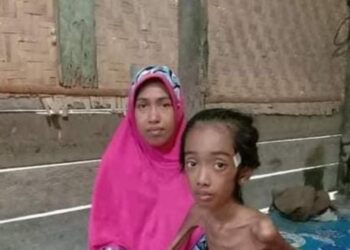 PUTRI Aura, 11, menghidap penyakit paru-paru dan demam kepialu sehingga menyebabkan badannya kurus keding. -KOMPAS.COM