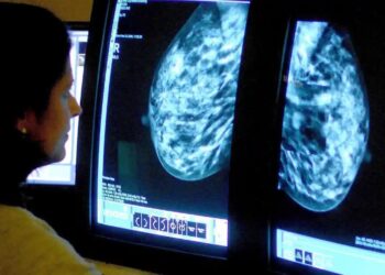 RIBOCICLIB mampu memberi hasil memberangsangkan kepada penghidap kanser payu dara yang berada pada fasa awal penyakit. - AGENSI