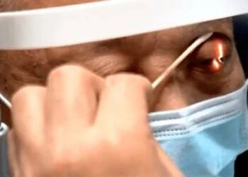 ZHANG menghidap sindrom air mata buaya yang menyebabkannya menangis ketika makan. - AGENSI