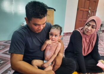 ZULNAZMI Che Ismail dan Fatin Suhana Mohd. Zamri bersama Muhammad Izzat Rafael yang menghidap penyakit kulit kronik di Kampung Keda Batu 13, Pokok Sena, Kedah. - UTUSAN/MOHD. RIFAAT ABD. HAMID