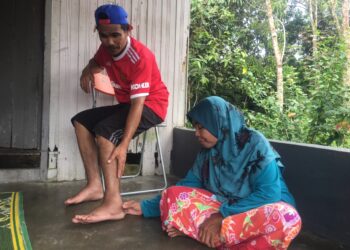 MAT Zaib Mat Min menunjukkan keadaan kakinya yang bengkak dan terpaksa duduk di atas kerusi sepanjang masa di rumahnya di Kampung Pangkal Changgong, Machang, Kelantan. – UTUSAN/ROSMIZAN RESDI