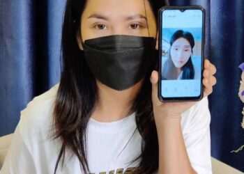 NIPAPRON Meeking menunjukkan gambar keadaan keningnya sebelum diperbaiki. - AGENSI