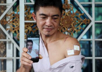 MOHD.  Syukri Zakaria menunjukkan kecederaan yang dialami di bahagian bahu kiri selepas diserang seekor beruang matahari di Kampung Tok Dor, Hulu Terengganu, minggu lalu. - UTUSAN/PUQTRA HAIRRY