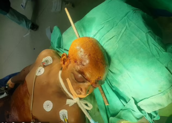 KEADAAN
mangsa sebelum
pembedahan
dijalankan di
Hospital Flores,
India. – AGENSI