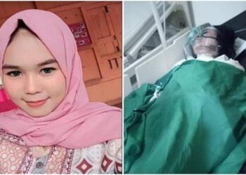 MANGSA yang dikenali sebagai Ningsih Marlina melecur 80 peratus pada badannya selepas dibakar kekasihnya. - AGENSI