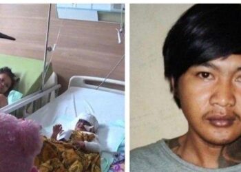 KANAK-KANAK berusia dua tahun (kiri) yang melecur di bahagian kelopak mata dan telinga akibat disimbah asid oleh bapanya (kanan) di Bekasi.-KOMPAS