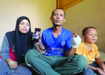 AZMI Salam menunjukkan jarinya yang terputus selepas terkena mesin pemotong kayu ketika ditemui di rumahnya di Projek Penempatan Masyarakat Setempat (PPMS) Kesedar Sejahtera, Gua Musang, Kelantan. – UTUSAN/AMUNI TUAN LAH