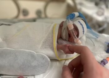 KEADAAN Zaylen Reed yang dilahirkan pramatang. - AGENSI 