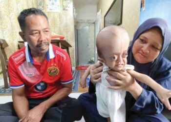 MAZNAH Omar (kanan) bersama suami menunjukkan keadaan
anaknya yang menghidap sindrom kepala besar di Kota Bharu, Kelantan. – UTUSAN/YATIMIN ABDULLAH