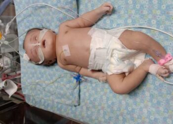 NUR Amni Badriah Shahrol sedang masih menerima rawatan di Hospital USM Kubang Kerian, Kota Bharu, Kelantan.