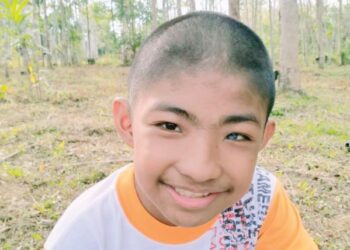 MUHAMMAD Faris Mohd. Fuad yang mempunyai mata kanan berwarna biru dan berwarna hitam di mata kiri ketika ditemui di Kampung Teluk Temelah, Baling. - UTUSAN/NORLIA RAMLI