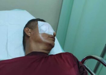 ZAHARMAN mengalami kecederaan pada matanya selepas dilastik oleh bapa seorang pelajarnya dalam satu kejadian di Bengkulu. - AGENSI