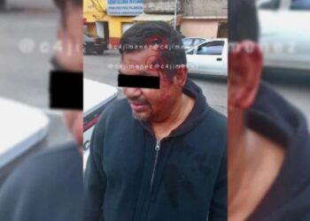 MANGSA mengalami kecederaan kecil selepas terkena tembakan dua kali di kepala. - AGENSI  