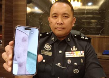 AHMAD ZAMRY MARINSAH menunjukkan gambar kecederaan yang dialami mangsa akibat dirotan bapanya.