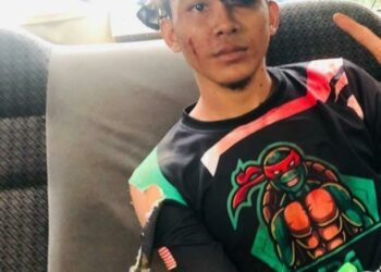 AL AMIN Ratna Shariman Alias mengalami kecederaan selepas diserang beruang di kebun durian di Kampung Lerek, Hulu Terengganu, semalam. 