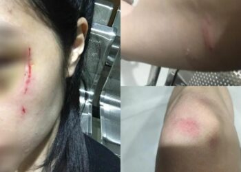 NATTARIKA mendakwa mengalami kecederaan di muka dan badannya. - AGENSI  