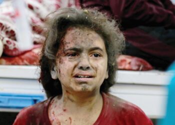 SEORANG gadis yang cedera menunggu rawatan di wad kecemasan hospital Al-Shifa berikutan serangan Israel di Bandar Gaza, Palestin semalam. - AFP