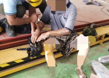 SEORANG pekerja penyelenggaraan melecur sehingga 30 peratus di bahagian kaki selepas terjatuh ke dalam kawah zink di sebuah kilang pembekal paip di Nibong Tebal, Pulau Pinang, hari ini.  - Pic: IHSAN BOMBA