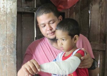 MOHAMAD Zainuddin Yusuf menunjukkan kecederaan anaknya yang diserang seekor beruk hutan minggu lalu ketika bermain di halaman rumahnya di Kampung Meranto, Gua Musang, Kelantan. – mingguan/AIMUNI TUAN LAH