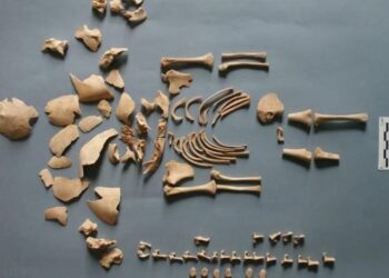 ENAM kes sindrom down dan satu kes sindrom Edward ditemukan dalam DNA manusia purba. - AGENSI