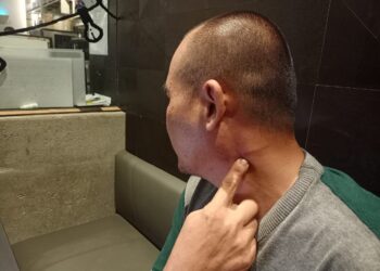 Chit Keong menunjukkan kecederaan dialaminya selepas dibelasah 30 individu pada malam Sabtu lalu.