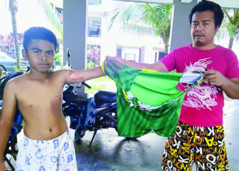 JAMALUDDIN Yusuf menunjukkan kesan terbakar pada baju anaknya, Muhammad Akil Mustakeem yang disambar api ketika melihat dua rakannya menyiapkan meriam buatan sendiri di Paya Nahu di Sungai Petani, Kedah.