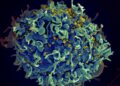 IMEJ mikroskop elektron Institut Kesihatan Kebangsaan AS menunjukkan sel manusia diserang virus HIV.-AGENSI