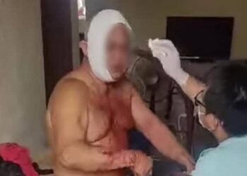 MANGSA diberikan rawatan oleh paramedik selepas mengalami kecederaan pada bahagian kepala dalam kejadian samun di Kampung Ayer Tawar, Jasin, Melaka.
