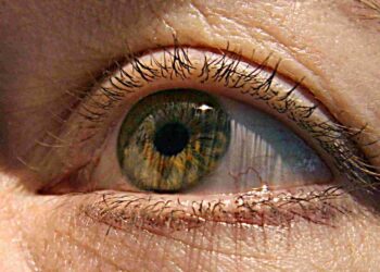 Koyakan dan lekangan retina adalah masalah serius yang boleh menyebabkan pesakit hilang penglihatan. - AFP