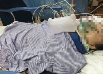 SITI Norelyana Kamarulzaman kini ditidurkan di Hospital Universiti Sains Malaysia (HUSM) Kubang Kerian.