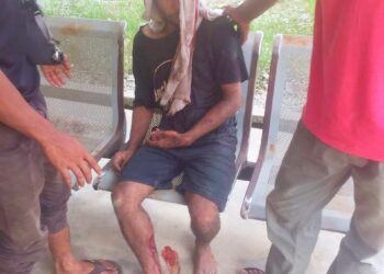KEADAAN mangsa yang selepas diserang seekor beruang dalam kejadian Kampung Dalam Senduk, Jerek, Gua Musang, Kelantan.