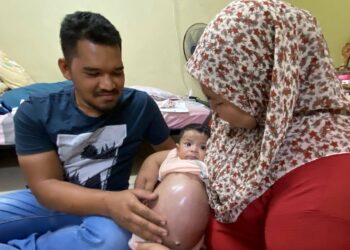 FARAH Nadia Khalid bersama suaminya Wan Hibatul Haziq memangku bayi mereka Wan Niyaz Mukhriz yang menghidap hemangioma dan budd chiari di rumah mereka di Rumah Rakyat Pengkalan Durian, Linggi, Port Dickson.-UTUSAN/NOR SHAFAWATI YUP