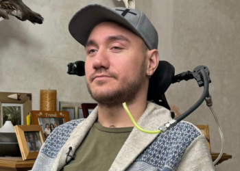 NOLAND Arbaugh kini mampu mengawal komputer menggunakan cip yang dipasang di dalam otaknya. – AGENSI