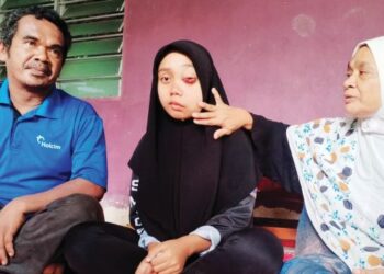 KEADAAN ketumbuhan di mata kiri Tuan Nur Aleya Afisya Tuan Khairulanuar yang sangat sensitif dan kerap mengeluarkan air bercampur darah. - UTUSAN/WAN ZURATIKAH IFFAH WAN ZULKIFLI