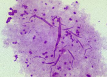 BAKTERIA Neisseria gonorrhoeae menyebabkan jangkitan penyakit gonorea.-AGENSI