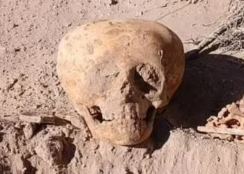 SATU tengkorak manusia dengan bentuk luar biasa ditemukan di San Fernando, Argentina. - AGENSI