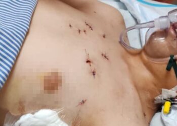 KEADAAN mangsa berusia 17 tahun yang kini dirawat di Hospital Melaka selepas mengalami kecederaan parah akibat tikaman.