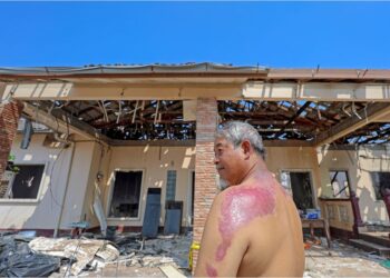 PENDUDUK, Mohmad Johar Misri menunjukkan kesan melecur pada belakang badan dan rumah sewanya yang musnah akibat letupan paip gas di Putra Heights di Kampung Kuala Sungai Baru, semalam.  – UTUSAN/FARIZ RUSADIO