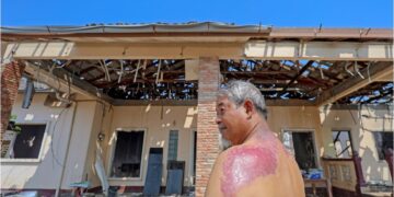 PENDUDUK, Mohmad Johar Misri menunjukkan kesan melecur pada belakang badan dan rumah sewanya yang musnah akibat letupan paip gas di Putra Heights di Kampung Kuala Sungai Baru, semalam.  – UTUSAN/FARIZ RUSADIO