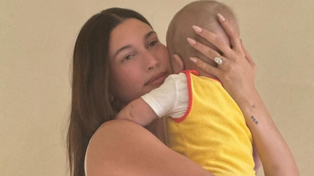 18 jam bertarung nyawa, Hailey Bieber dedah alami pendarahan teruk