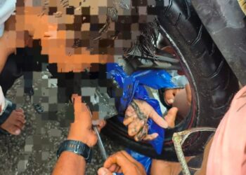 SEORANG kanak-kanak lelaki cedera selepas tangannya tersepit pada rim motosikal dalam satu kemalangan di Jalan Tok Wan Don, berdekatan Masjid Jamek Permatang Pasir, Balik Pulau, Pulau Pinang.