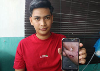 WAN Ahmad Wan Endot menunjukkan kecederaan yang dialaminya selepas digigit anjing liar di Taman Lukut Makmur, Port Dickson semalam. - UTUSAN/ NOR AINNA HAMZAH