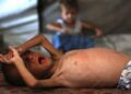 MOHAMMED al-Mutawaq, bayi lelaki berusia 18 bulan terbaring lemah akibat kekurangan nutrisi susulan kebuluran di Gaza selepas rejim Israel menyekat kemasukan bantuan kemanusiaan. – AFP