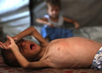 MOHAMMED al-Mutawaq, bayi lelaki berusia 18 bulan terbaring lemah akibat kekurangan nutrisi susulan kebuluran di Gaza selepas rejim Israel menyekat kemasukan bantuan kemanusiaan. – AFP