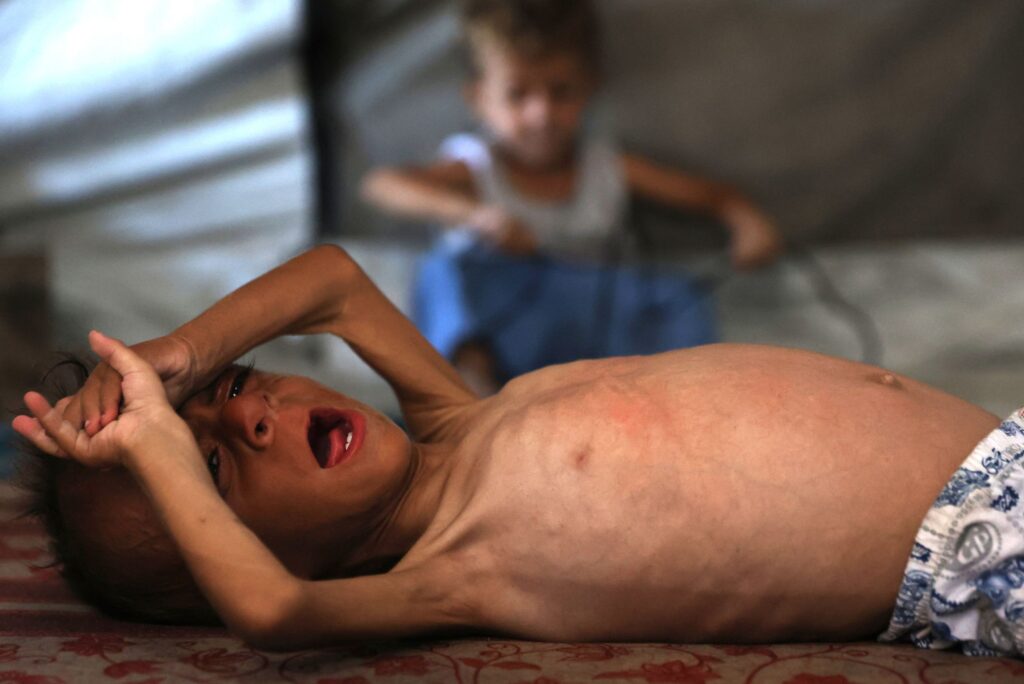 Kumpulan pertama kanak-kanak Gaza akan dipindah ke UK untuk rawatan