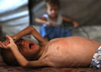 MOHAMMED al-Mutawaq, bayi lelaki berusia 18 bulan terbaring lemah akibat kekurangan nutrisi susulan kebuluran di Gaza selepas rejim Israel menyekat kemasukan bantuan kemanusiaan. – AFP