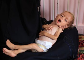 SEORANG bayi perempuan, Sham Qadeeh yang mengalami kekurangan nutrisi dipangku ibunya di Hospital Nasser di Khan Younis, Gaza.