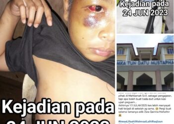 Jabatan Pendidikan Negeri (JPN) Sabah diminta menyiasat segera berhubung dakwaan kes buli yang melibatkan murid di sebuah sekolah di negeri itu, dua tahun lalu.